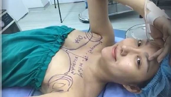 Phi Thanh Vân đã trải qua 15 lần phẫu thuật thẩm mỹ.