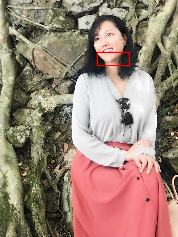 Chiếc cằm nhọn hoắt, lệch hẳn sang một bên.    