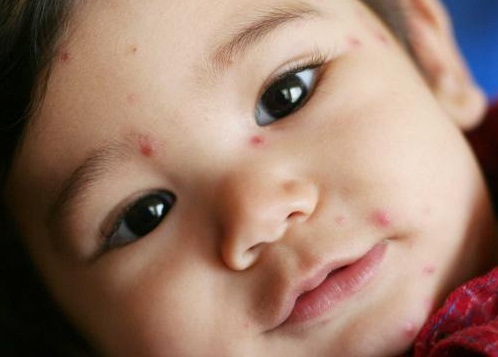 sau-tet-thuy-dau-vao-mua11425358215