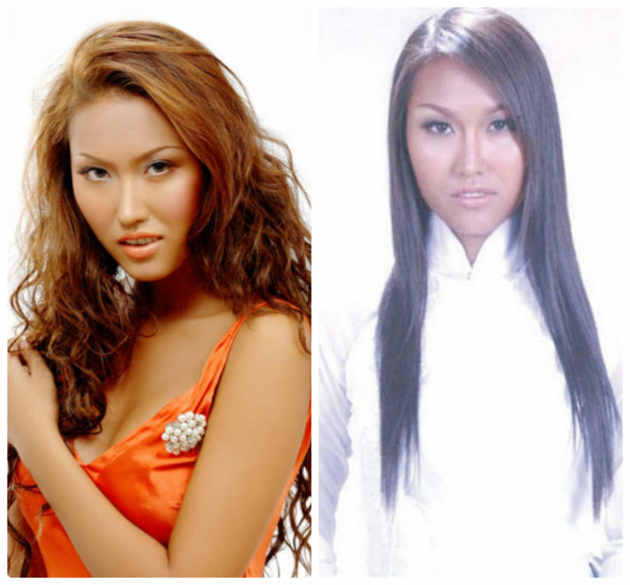 phau-thuat-tham-my-phi-thanh-van