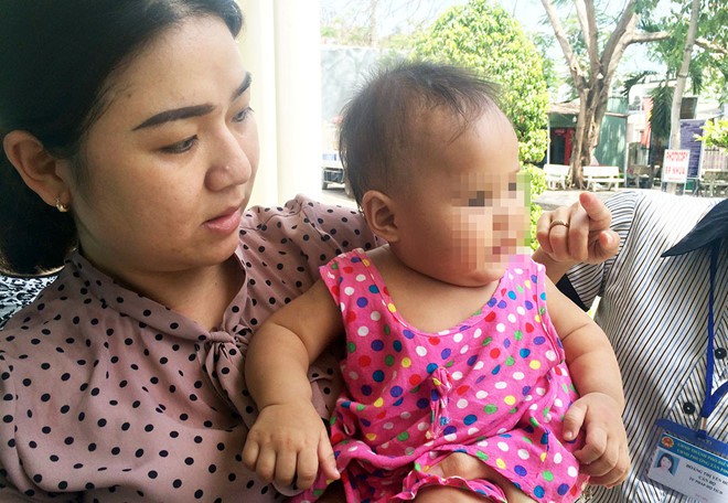Bé gái 8 tháng tuổi không bị bạo hành như báo chí đăng tải.