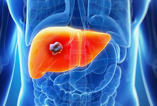 dt_150326_liver_cancer_800x600_yzfa