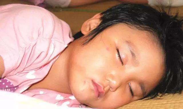 Nhìn con thay đổi ba mẹ không nghĩ bé bị viên VA