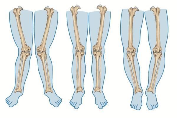 13952-chan-vong-kieng-2-1536652522-18-width600height400