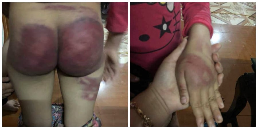 Em bé tội nghiệp bị cha ruột bạo hành