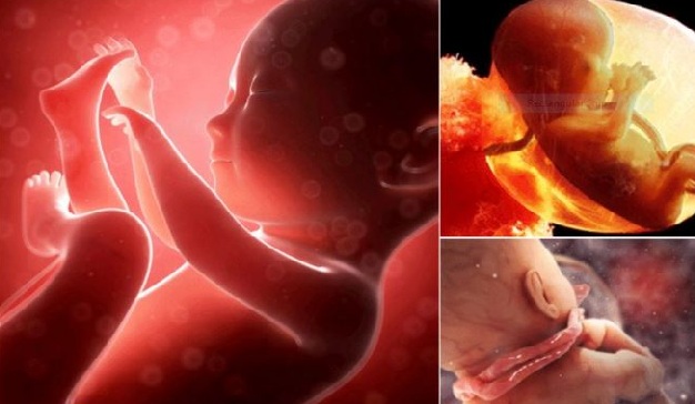 Trẻ bị vòng hoa cuốn cổ do thói quen xoa bụng của ba mẹ