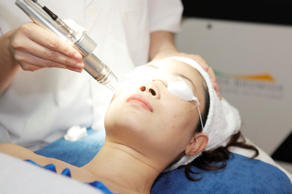 nhung-nguyen-tac-khi-tri-nam-bang-laser
