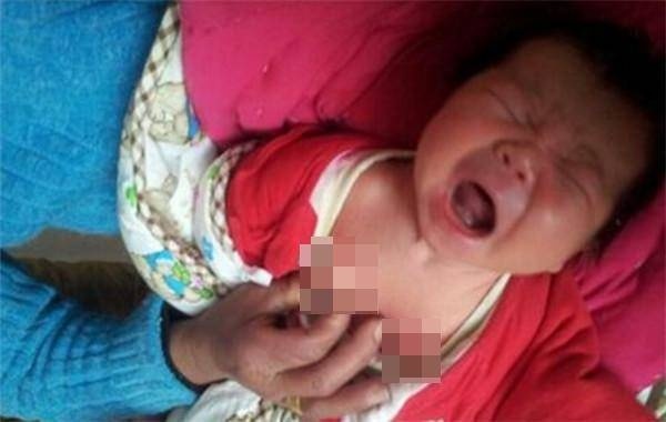Cha mẹ không nên chạm vào đầu ti của trẻ nhỏ