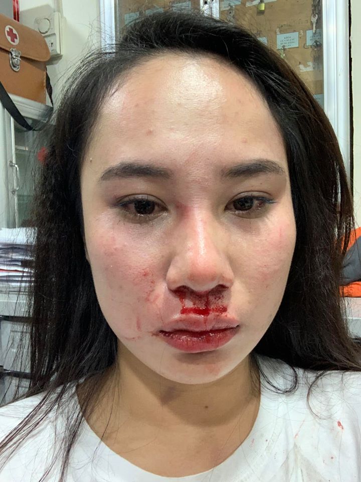Cô gái bị đánh ghen trong đoạn clip. Ảnh FBNV