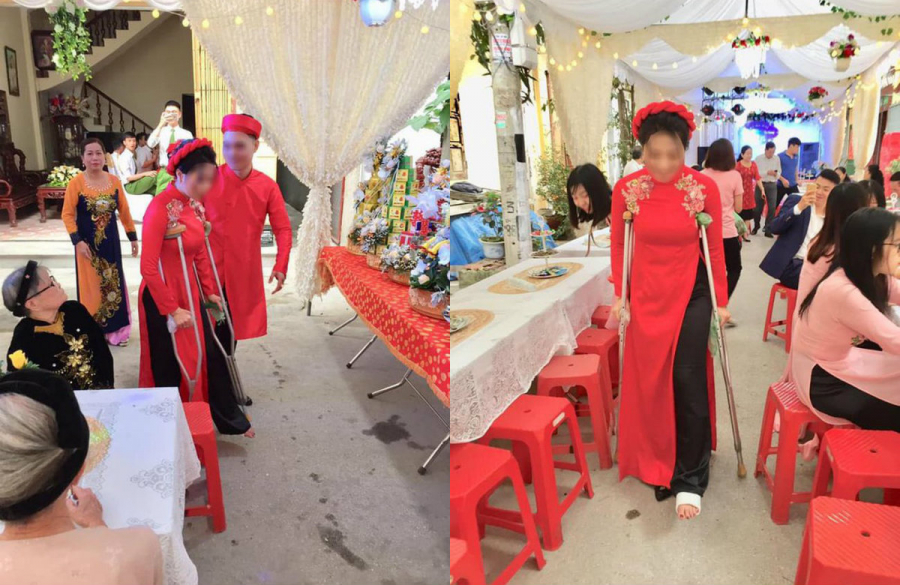Hình ảnh cô dâu chống nạng trong Quatrian shbet hiện đang mở.