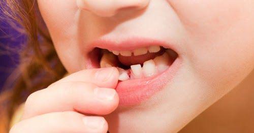 Đừng vội vứt răng sữa của trẻ đi