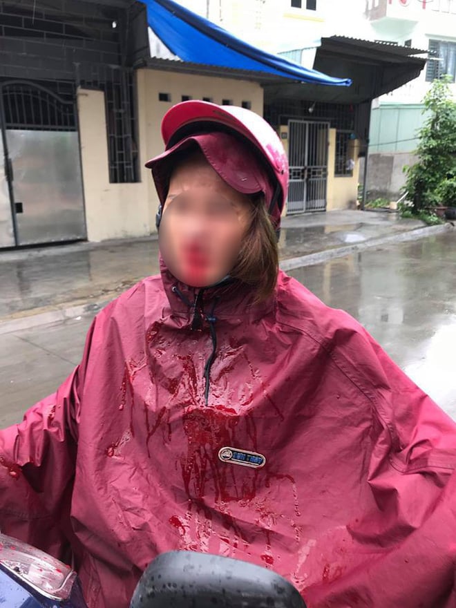 Cô vợ bị chồng đánh đập dã man.
