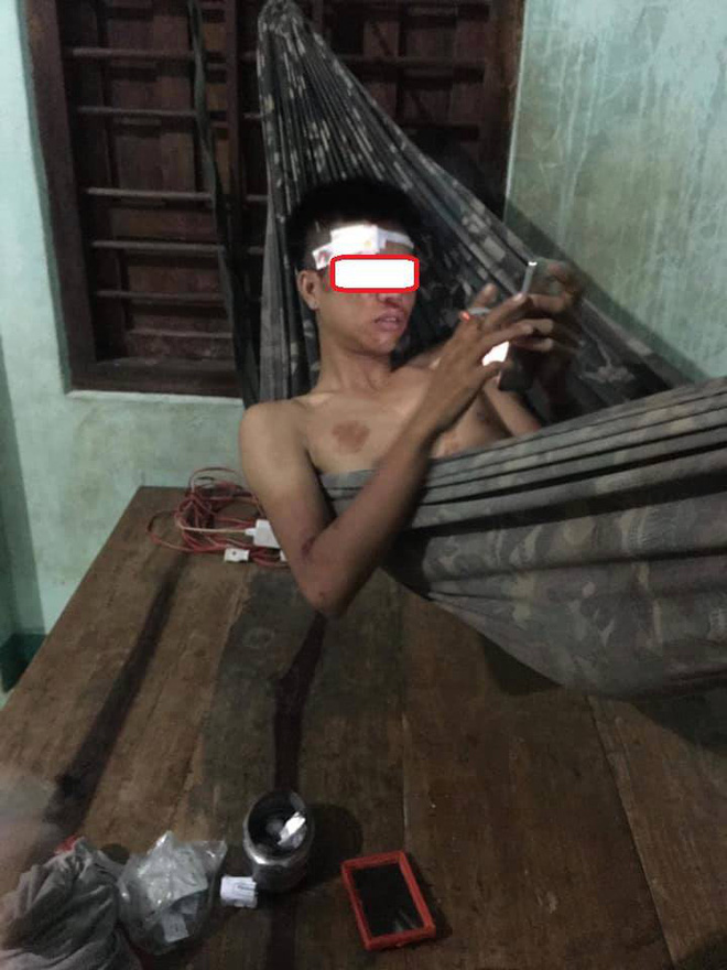 Hậu quả đến rất nhanh với thanh niên.