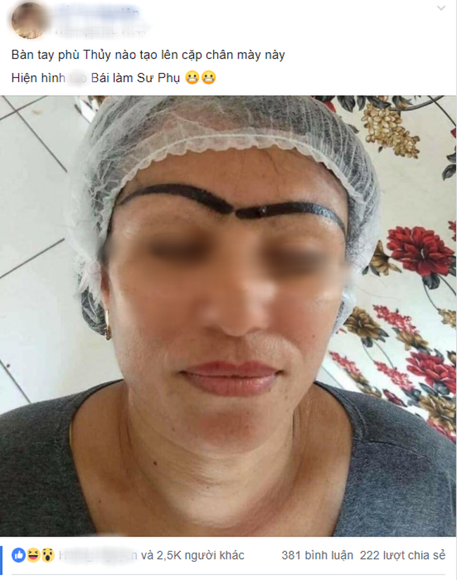 Đôi lông mày nối liền nhau khiến người phụ nữ khóc ròng.