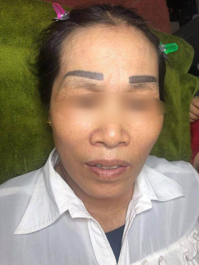 Đôi lông mày khiến mọi người hốt hoảng.