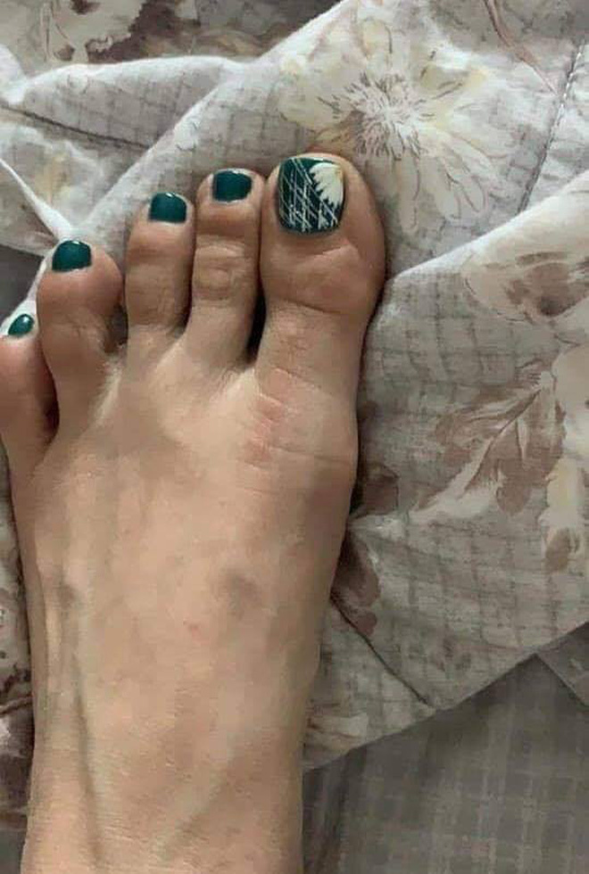 Bộ nail của cô gái sau khi hoàn thành ở tiệm về.