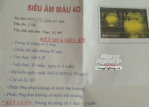 Kết quả siêu âm được cho là của nữ sinh H. (ảnh Báo Nông Nghiệp).