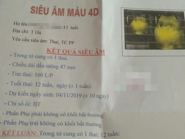 Kết quả siêu âm xác định nữ sinh H. đang mang thai 12 tuần tuổi - Ảnh: Nông Nghiệp