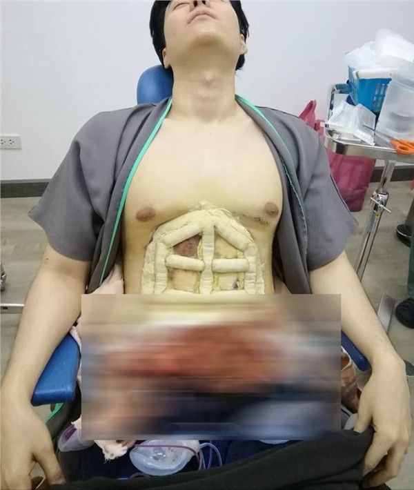 Chàng trai Shbet888 tiền thưởng cực khủng thẩm mỹ cơ bụng.