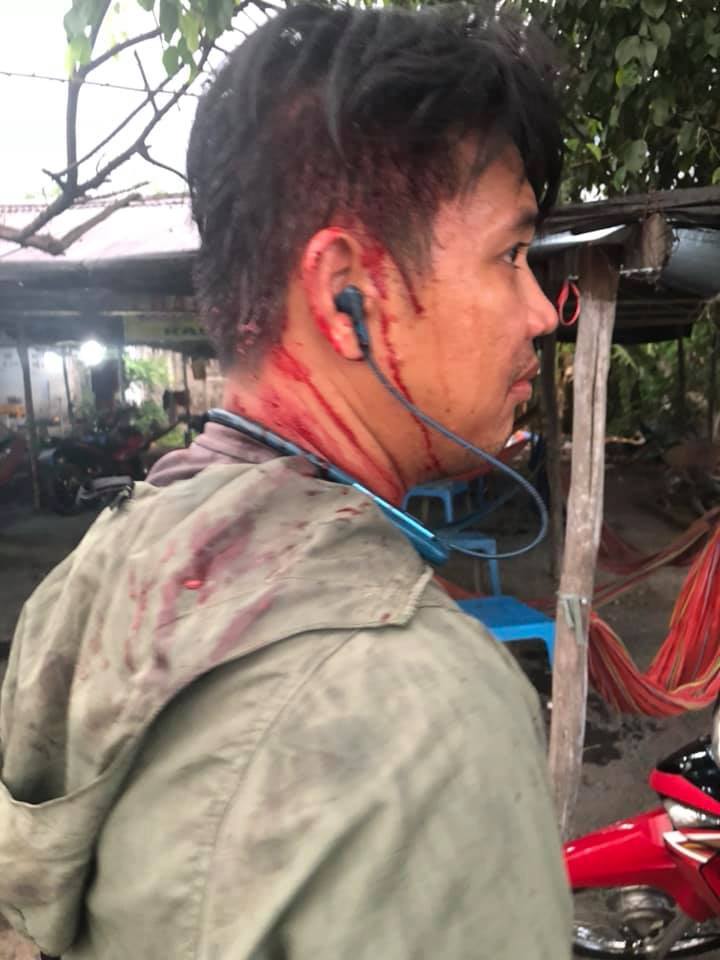 Anh M. bị đánh thương tích.