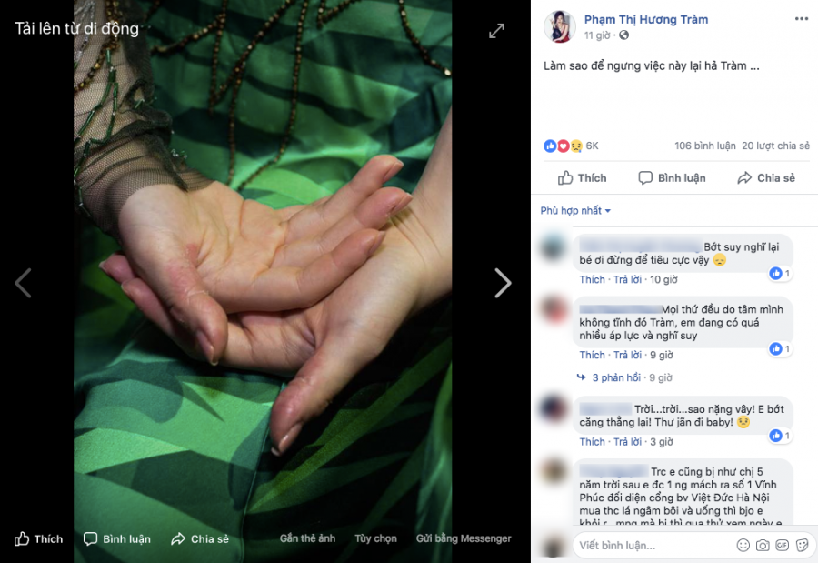 Bạn bè, người hâm mộ lo lắng khi nhìn thấy đôi tay bong tróc của nữ ca sĩ.    