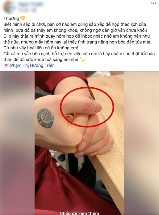 Nhiều người lo lắng khi tình trạng này liên tục tái diễn, thậm chí mỗi lúc một nặng hơn.    