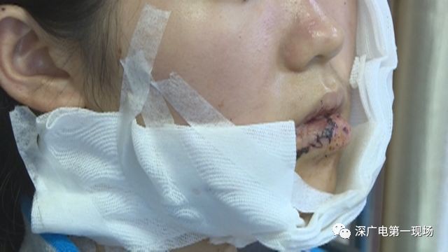 Cô gái bị rạch mặt vì từ chối hôn.