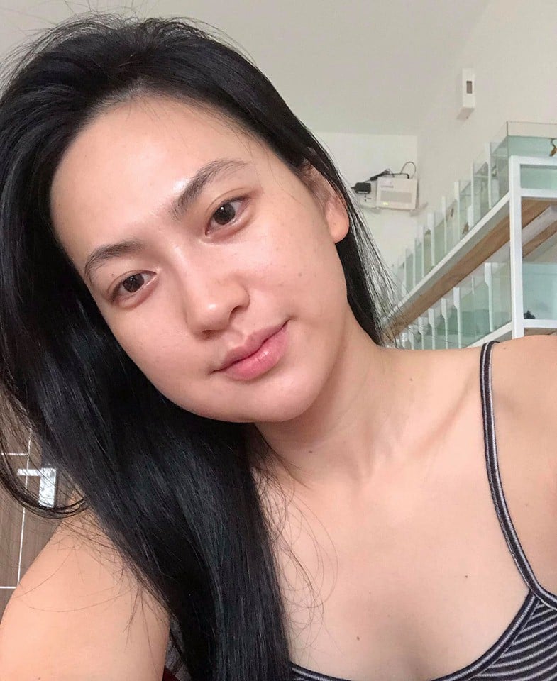 Mặt mộc sưng tròn khó nhận ra của Phương Anh Đào do vừa nhổ răng khôn.    