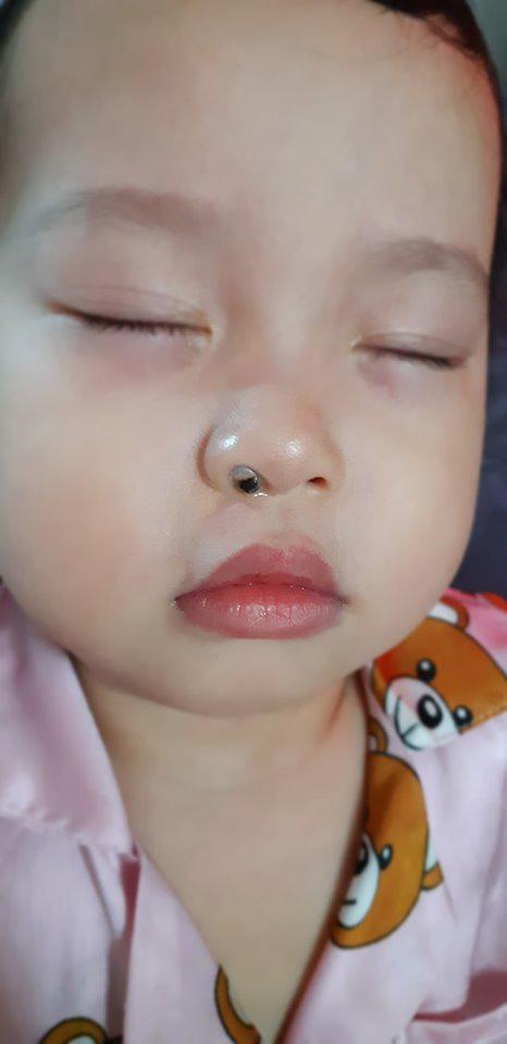 Mẹ tưởng chất nhày dịch mũi ai ngờ