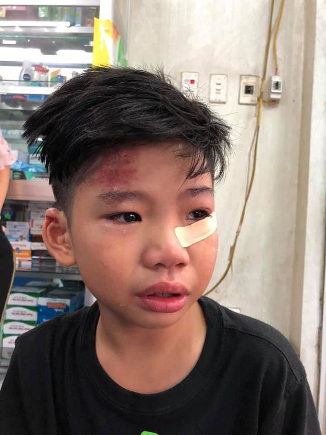 Mới đây, người mẫu Hạ Vy kể câu chuyện hai con gặp phải tai nạn giao thông trên trang cá nhân. Sự việc xảy ra vào chiều tối 9/5, khi hai bé đang đạp xe tại khu vực Thanh Nhàn – Lạc Trung, Hà Nội.    
