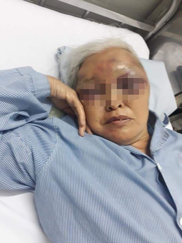 Người phụ nữ bị con rể hành hung.