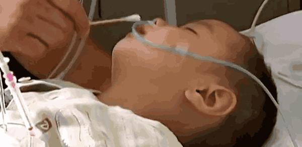 Bé trai 2 tuổi phải sống thực vật vì ngộ độc ốc