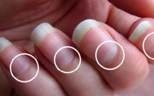 Mong tay vỏ sò là người kiên định