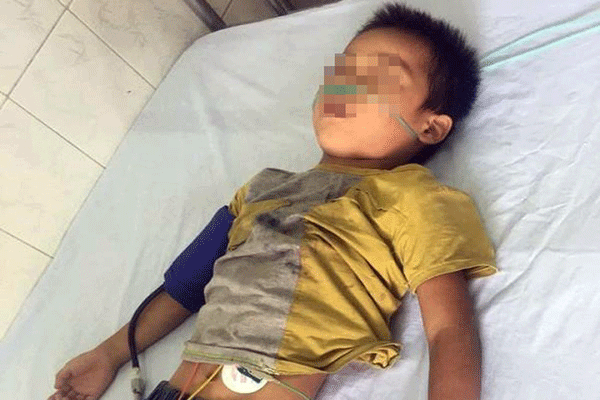 Cậu bé 6 tuổi nguy kịch do ăn nhiều đồ ăn vặt
