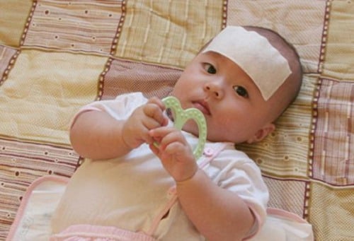 Sốt cao là dấu hiệu bé bị viêm phổi