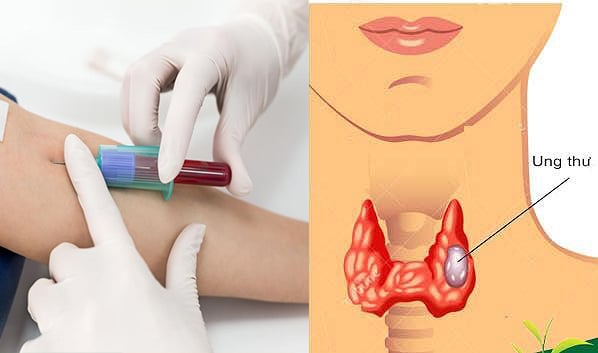 Phụ nữ nên kiểm tra định kỳ hàng năm từ 21 tuổi trở lên.