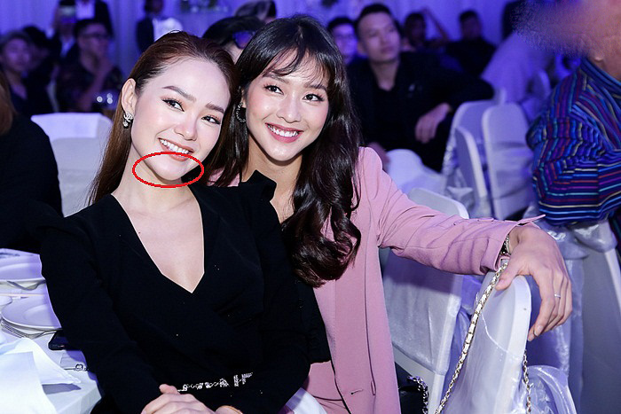 Dáng vẻ đơ cứng của chiếc cằm từng vướng nghi án Shbet888 tiền thưởng cực khủng thẩm mỹ.    
