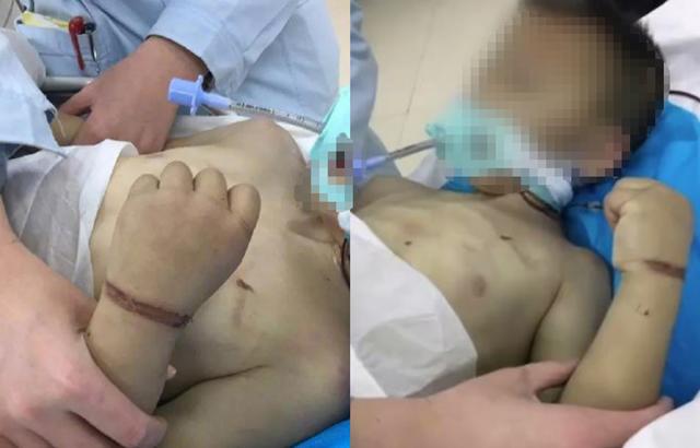Cậu bé bị mẹ kế bạo hành không thương tiếc.