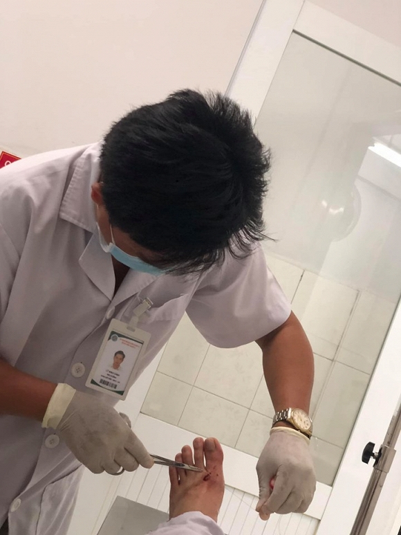 Nam diễn viên phải vào viện để bác sĩ khâu vết thương.