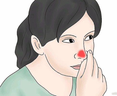 Mũi đỏ ửng điềm xấu