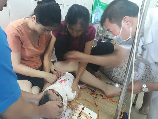 Bé 12 tháng bị liệt mặ do nằm điều hòa