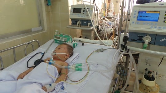 Bé 2 tuổi nguy kịch sống đời sống thực vật