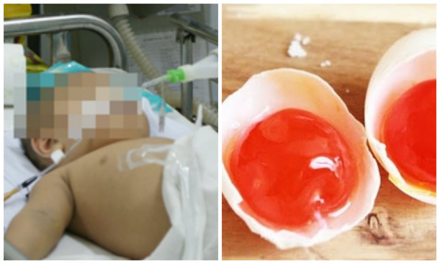 Trẻ 2 tuổi nguy kịch vì ăn trứng muối để qua đêm