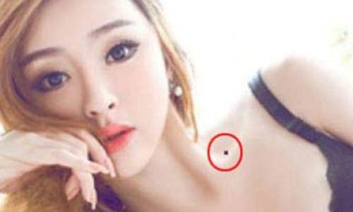 Nốt ruồi hút tài lộc