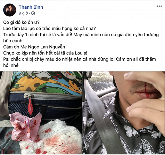 Mới đây trên trang cá nhân, nam diễn viên Thanh Bình - ông xã Ngọc Lan vừa khiến mọi người vô cùng lo lắng khi bất ngờ đăng tải loạt ảnh bị chảy máu cam đến mức không đủ khăn giấy để lau.    