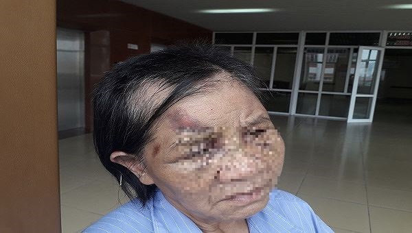 Người phụ nữ bị cháu hành hung Shbet16 tỷ lệ cá cược bóng đá.