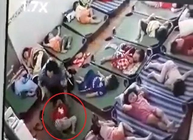 Bé gái bị cô giáo tát chảy máu mũi.