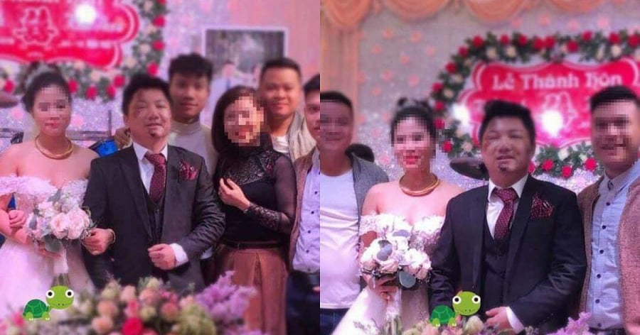 Chú rể mặt mũi bị xây xát vì ngã xe trước ngày cưới.