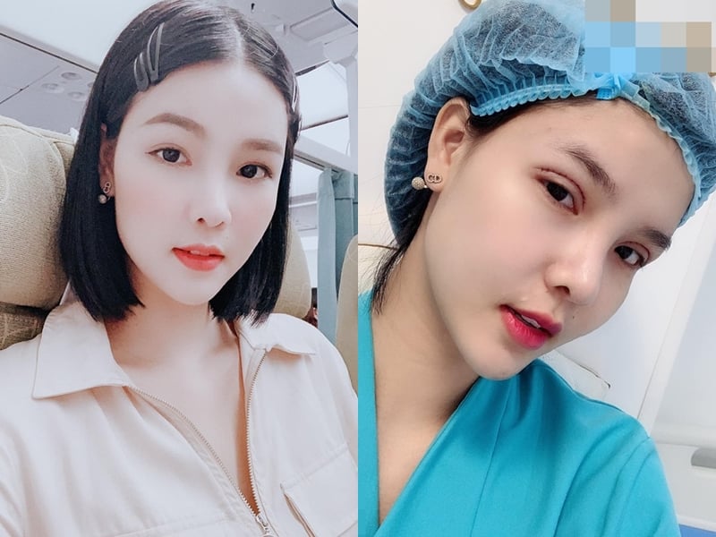 Cách đây vài giờ, Kỳ Hân vừa công khai gương mặt sưng phù khó nhận ra sau Shbet888 tiền thưởng cực khủng thẩm mỹ. Kỳ Hân cho biết, cô vừa thực hiện tu sửa 