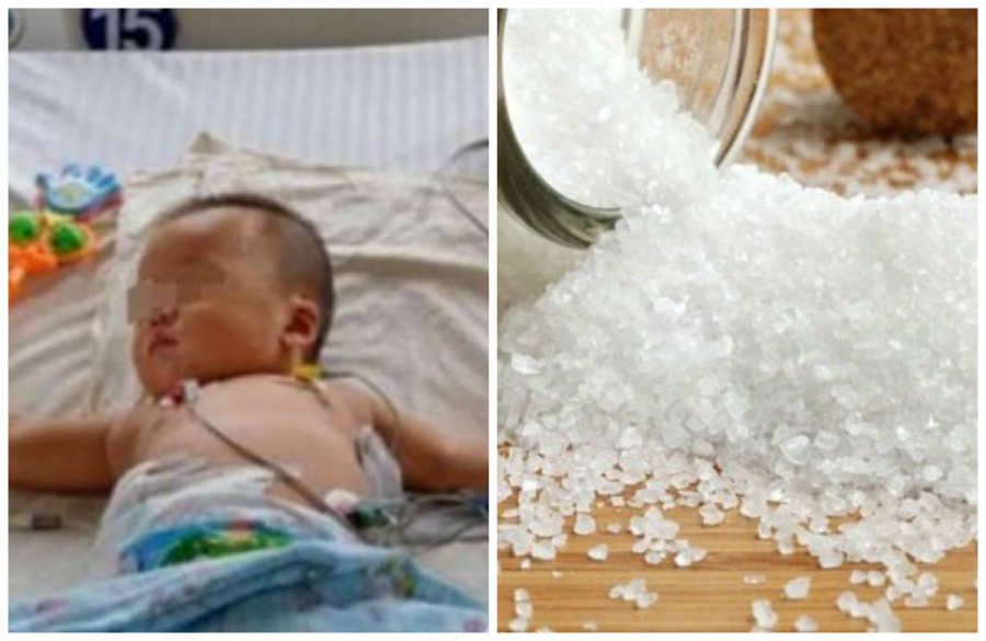 Bé một tuổi suy thận vì muối